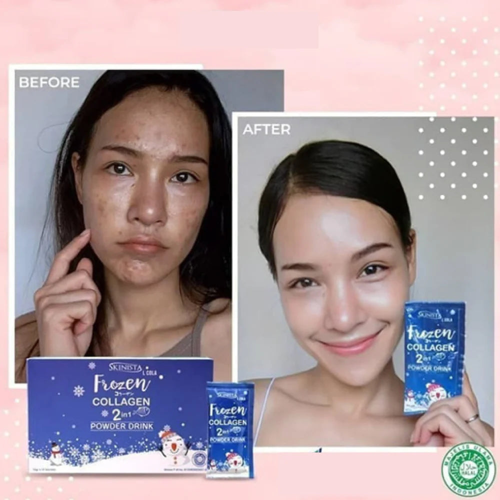 Gluta Frozen Full Body Whitening Capsules (60 Collagen Capsule) 2 in 1 - The Skin Lab