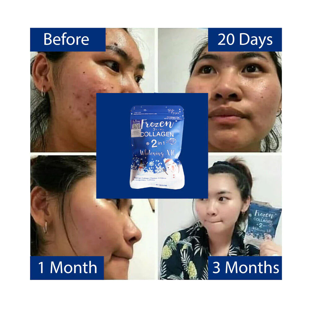 Gluta Frozen Full Body Whitening Capsules (60 Collagen Capsule) 2 in 1 - The Skin Lab