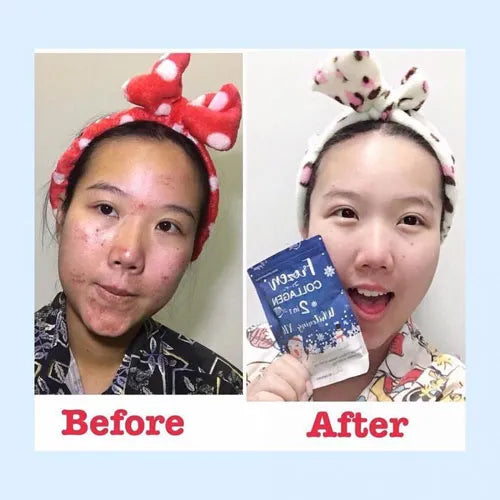 Gluta Frozen Full Body Whitening Capsules (60 Collagen Capsule) 2 in 1 - The Skin Lab