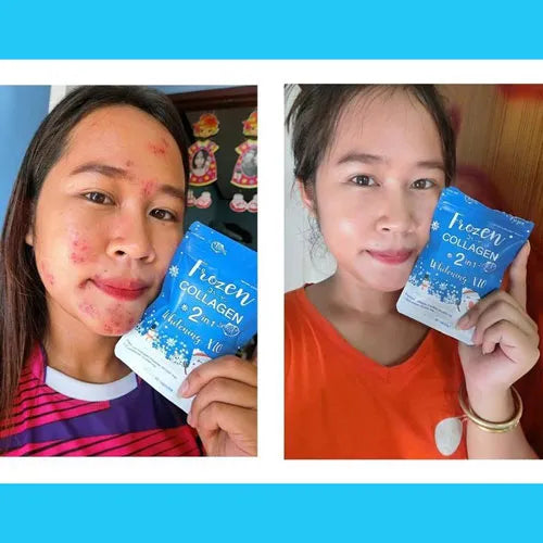 Gluta Frozen Full Body Whitening Capsules (60 Collagen Capsule) 2 in 1 - The Skin Lab
