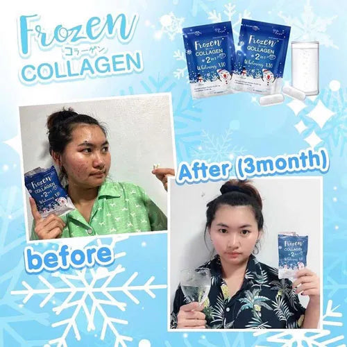 Gluta Frozen Full Body Whitening Capsules (60 Collagen Capsule) 2 in 1 - The Skin Lab