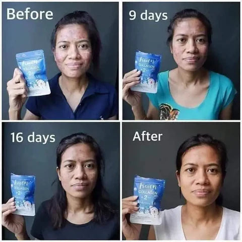 Gluta Frozen Full Body Whitening Capsules (60 Collagen Capsule) 2 in 1 - The Skin Lab
